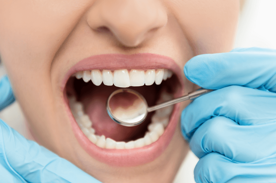 How Long Does A Dental Cleaning Take?